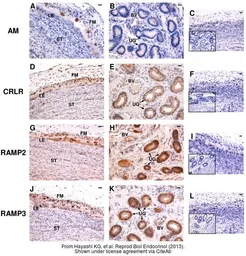 Rabbit IgG isotype control. GTX35035