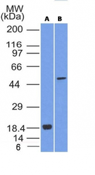 Anti-SOX10 antibody [SOX10/1074] used in Western Blot (WB). GTX35084