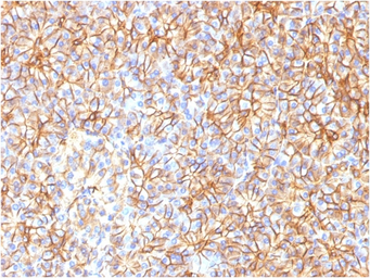 Anti-SPTBN2 antibody [SPTBN2/1584] used in IHC (Paraffin sections) (IHC-P). GTX35091