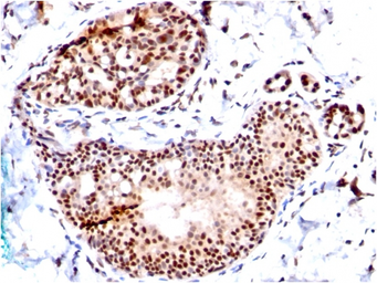 Anti-SUMO1 antibody [SM1/495] used in IHC (Paraffin sections) (IHC-P). GTX35092