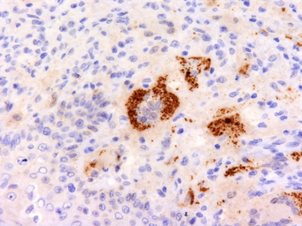 Anti-TNF alpha antibody [P/T2] used in IHC (Paraffin sections) (IHC-P). GTX35133