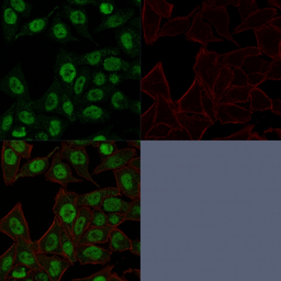 Anti-Topoisomerase II alpha antibody [TOP2A/1361] used in Immunocytochemistry/ Immunofluorescence (ICC/IF). GTX35137