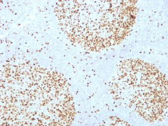 Anti-Topoisomerase II alpha antibody [TOP2A/1361] used in IHC (Paraffin sections) (IHC-P). GTX35137