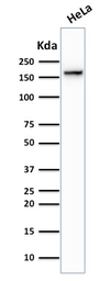 Anti-Topoisomerase II alpha antibody [TOP2A/1362] used in Western Blot (WB). GTX35138