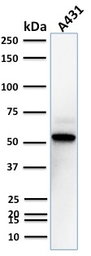 Anti-TOX3 antibody [TOX3/1123] used in Western Blot (WB). GTX35139