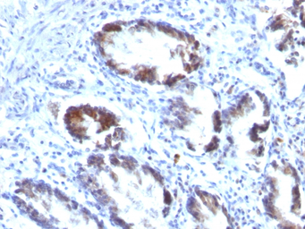 Anti-Transgelin antibody [TAGLN/247] used in IHC (Paraffin sections) (IHC-P). GTX35141