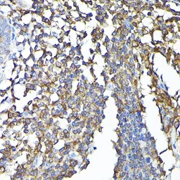 Anti-CSK antibody used in IHC (Paraffin sections) (IHC-P). GTX35201