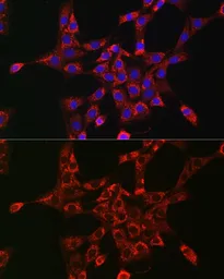 Anti-RAB5A antibody used in Immunocytochemistry/ Immunofluorescence (ICC/IF). GTX35207