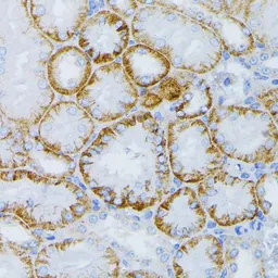 Anti-MEK1 antibody used in IHC (Paraffin sections) (IHC-P). GTX35212