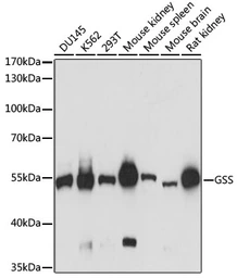 Anti-GSS antibody used in Western Blot (WB). GTX35220