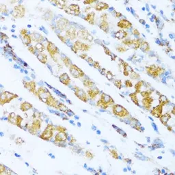 Anti-NDUFA5 antibody used in IHC (Paraffin sections) (IHC-P). GTX35222