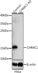 Anti-CHRAC1 antibody used in Western Blot (WB). GTX35225