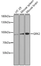 Anti-GRK2 antibody used in Western Blot (WB). GTX35230