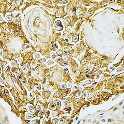 Anti-GRK2 antibody used in IHC (Paraffin sections) (IHC-P). GTX35230