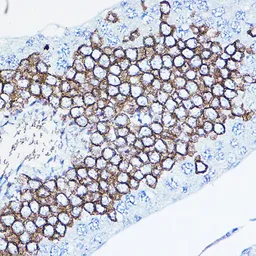 Anti-Her2 / ErbB2 antibody used in IHC (Paraffin sections) (IHC-P). GTX35231