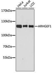 Anti-ARHGEF1 antibody used in Western Blot (WB). GTX35236