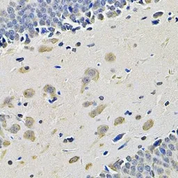 Anti-Integrin alpha 2 antibody used in IHC (Paraffin sections) (IHC-P). GTX35237