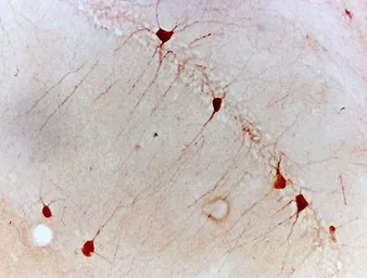 Anti-Netrin 1 antibody used in IHC (Paraffin sections) (IHC-P). GTX37361