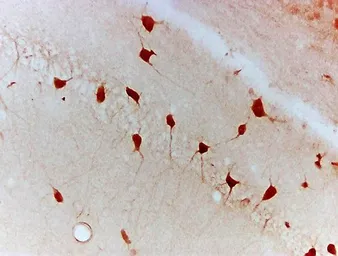 Anti-Netrin 1 antibody used in IHC (Paraffin sections) (IHC-P). GTX37361