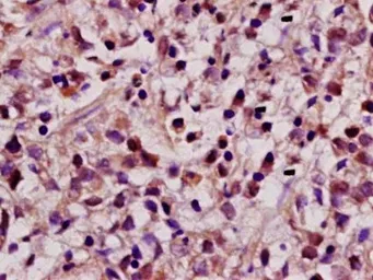 Anti-REST antibody used in IHC (Paraffin sections) (IHC-P). GTX37363
