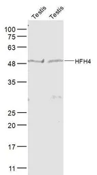 Anti-FOXJ1 antibody used in Western Blot (WB). GTX37424