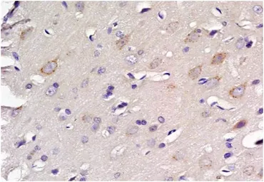 Anti-EAAT2 antibody used in IHC (Paraffin sections) (IHC-P). GTX37432