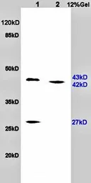Anti-PACAP antibody used in Western Blot (WB). GTX37576