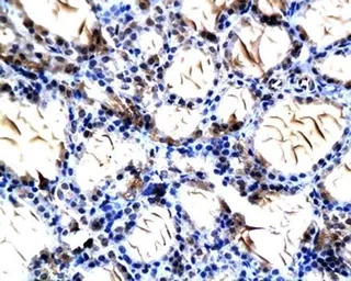Anti-NIS antibody used in IHC (Paraffin sections) (IHC-P). GTX37599
