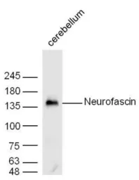 Anti-Neurofascin 155 antibody used in Western Blot (WB). GTX37602