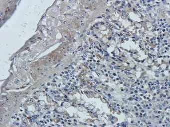 Anti-Leptin Receptor antibody used in IHC (Paraffin sections) (IHC-P). GTX37636