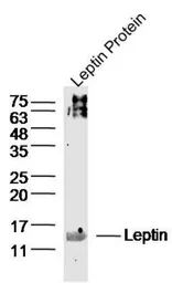 Anti-Leptin antibody used in Western Blot (WB). GTX37638