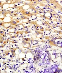 Anti-Kiss1 antibody used in IHC (Paraffin sections) (IHC-P). GTX37642