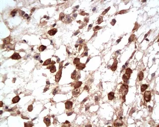 Anti-GLUT2 antibody used in IHC (Paraffin sections) (IHC-P). GTX37686