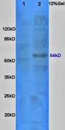 Anti-GLUT2 antibody used in Western Blot (WB). GTX37686