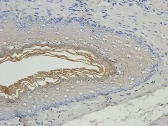 Anti-Filaggrin antibody used in IHC (Paraffin sections) (IHC-P). GTX37695