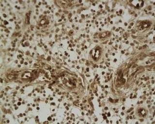 Anti-beta 2 Defensin antibody used in IHC (Paraffin sections) (IHC-P). GTX37716