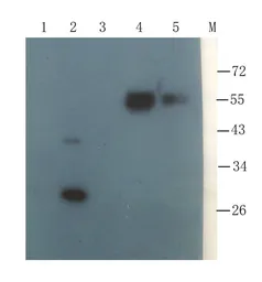 Anti-Collagen X antibody used in Western Blot (WB). GTX37732