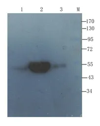 Anti-Collagen X antibody used in Western Blot (WB). GTX37732