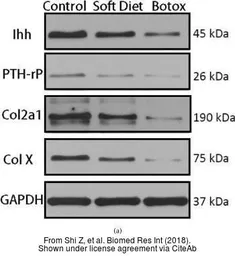 Anti-Collagen X antibody used in Western Blot (WB). GTX37732