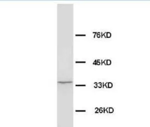 Anti-WDR83 antibody used in Western Blot (WB). GTX38544