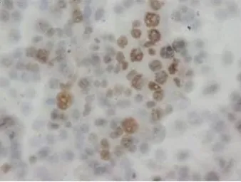 Anti-API5 antibody used in IHC (Paraffin sections) (IHC-P). GTX38554