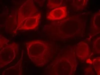 Anti-Her3 / ErbB3 (phospho Tyr1328) antibody used in Immunocytochemistry/ Immunofluorescence (ICC/IF). GTX38571