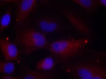 Anti-PAK1 ( phospho Thr423 ) / PAK2 ( phospho Thr402 ) / PAK3 ( phospho Thr436 ) antibody used in Immunocytochemistry/ Immunofluorescence (ICC/IF). GTX38587