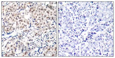 Anti-p27 Kip1 (phospho Thr187) antibody used in IHC (Paraffin sections) (IHC-P). GTX38594