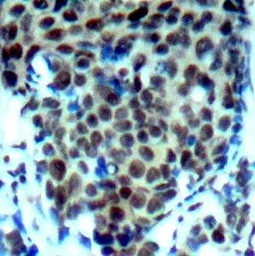 Anti-p38 MAPK (phospho Thr180) antibody used in IHC (Paraffin sections) (IHC-P). GTX38595