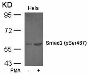 Anti-SMAD2 (phospho Ser467) antibody used in Western Blot (WB). GTX38629