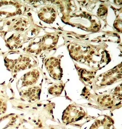 Anti-MEF2A (phospho Ser408) antibody used in IHC (Paraffin sections) (IHC-P). GTX38634