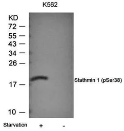 Anti-Stathmin 1 (phospho Ser38) antibody used in Western Blot (WB). GTX38638