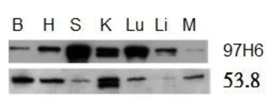 Anti-Talin-2 antibody [53.8] used in Western Blot (WB). GTX38970