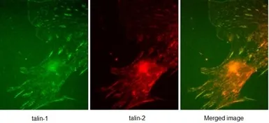 Anti-Talin-1 antibody [97H6] used in Immunocytochemistry/ Immunofluorescence (ICC/IF). GTX38972